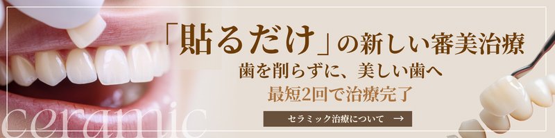 「貼るだけ」の新しい審美治療歯を削らずに、美しい歯へ最短2回で治療完了
